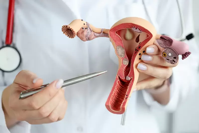 Cirurgia Íntima a Laser